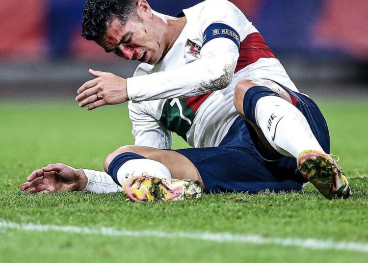 (VIDEO) Cristiano Ronaldo recibió violento golpe en la nariz que asustó a todos en República Checa-Portugal