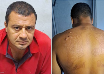 «El Crazy» intentó borrarse los tatuajes, pero ni así escapó a la guerra contra las pandillas