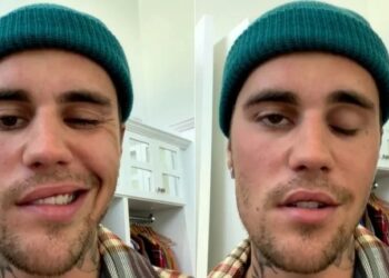 Justin Bieber suspende conciertos en Argentina por avances del síndrome que padece