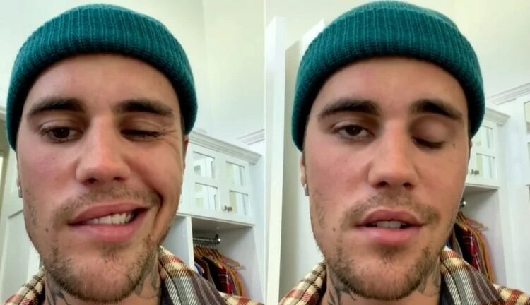 Justin Bieber suspende conciertos en Argentina por avances del síndrome que padece