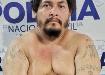 Sujeto intentó borrarse los tatuajes alusivos de pandillas pero fue capturado por la PNC