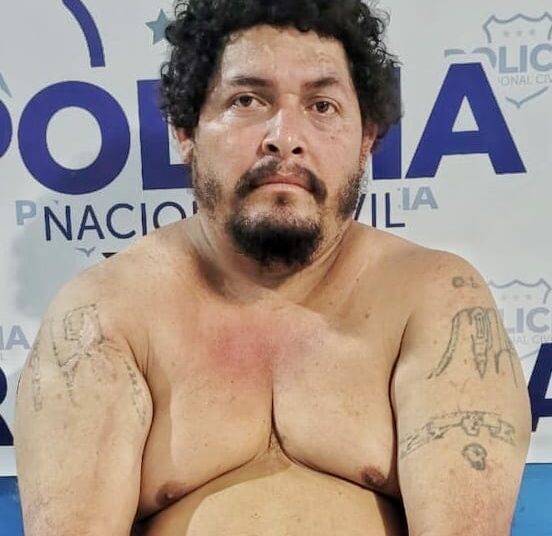 Sujeto intentó borrarse los tatuajes alusivos de pandillas pero fue capturado por la PNC