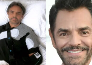 Eugenio Derbez reaparece en redes en una sesión de fisioterapia