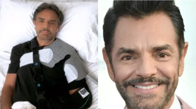 Eugenio Derbez reaparece en redes en una sesión de fisioterapia