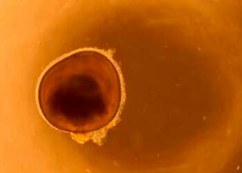 Crean miniojos en laboratorio que podrían ayudar a curar la ceguera