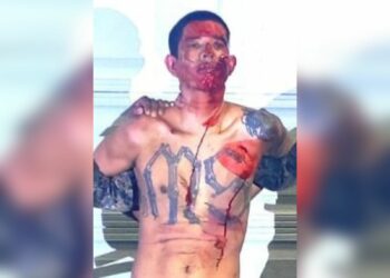 Capturan a pandillero que resultó lesionado al intentar huir