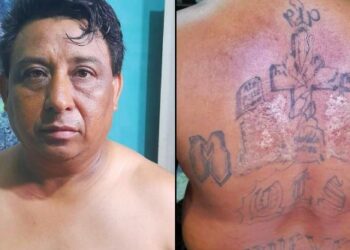 Pandillero que intentó quemar sus tatuajes fue capturado en Nejapa
