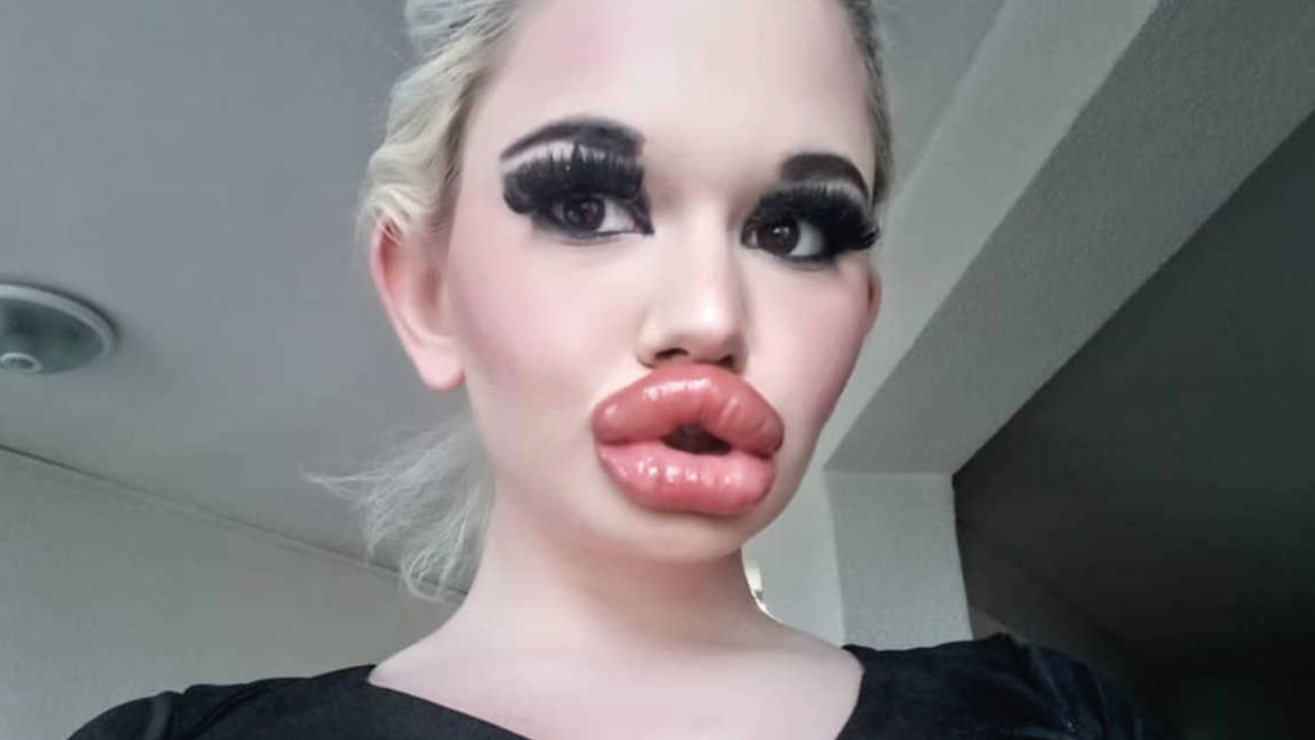 La Mujer Con Los Labios Más Grandes Del Mundo Va Por Un Nuevo Récord Diario La Página 0580