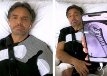 Eugenio Derbez confiesa sus miedos por el accidente: “Pensé que podía perder el brazo”