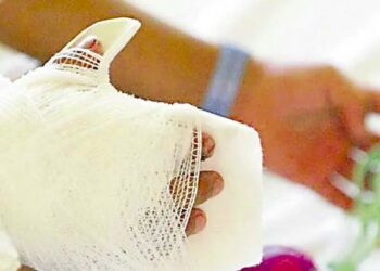 Salud contabiliza una reducción de personas quemadas durante época navideña