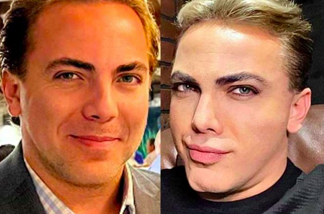 Cristian Castro reaparece con radical cambio en su rostro y lo comparan con el Ken humano