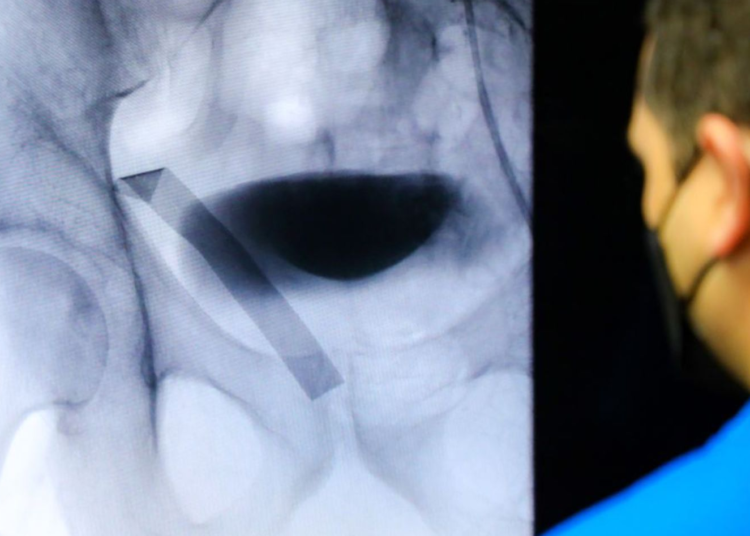 Solo este año serán ejecutados 50 implantes de válvula aórtica en pacientes cardiacos en el ISSS