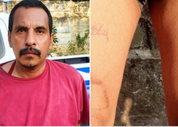 Terrorista intentó borrar sus tatuajes alusivos a pandillas pero fue detenido en Sonsonate