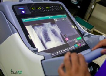 Hospital Santa Gertrudis de San Vicente, adquiere moderno equipo de rayos X