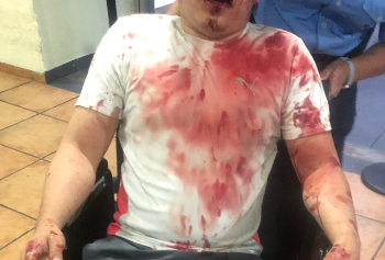 Acusan a joven de dar brutal golpiza a otro en lujosa residencial de La Libertad