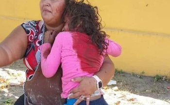 Niña que iba a comprar tortillas fue atacada por un pitbull en San Pedro Masahuat