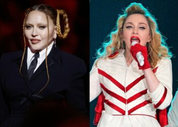 Madonna, desesperada por recuperar su rostro natural antes de su gira mundial
