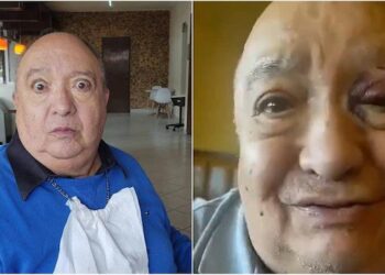 Luis de Alba «El Pirruris» sufrió un aparatoso accidente