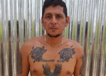Pandillero que intentó borrarse los tatuajes fue detenido en Cacaopera