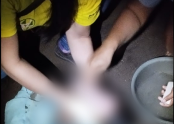 Socorristas rescatan a un bebé de una fosa séptica en Zapotitán, la madre ignoraba que estaba embarazada