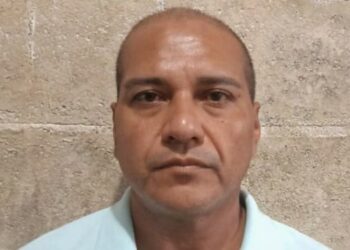 Fallece mujer que fue golpeada con un bate en la cabeza por su compañero de vida