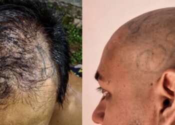 Detienen a pandillero que se dejó crecer el cabello para ocultar tatuajes alusivos a maras