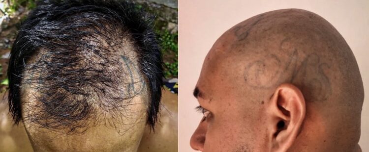 Detienen a pandillero que se dejó crecer el cabello para ocultar tatuajes alusivos a maras