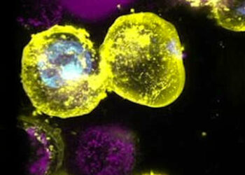 Millones de personas portan una mutación genética que aumenta el riesgo de muerte celular explosiva