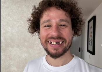 Luisito Comunica: esta es la verdad detrás de la caída de sus dientes