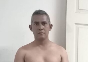 Pandillero que intentó borrarse un tatuaje alusivo al barrio 18 ya fue capturado