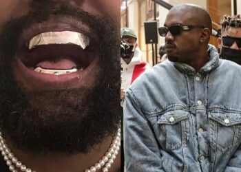 Kanye West se implantó una dentadura de titanio que vale 850.000 dólares