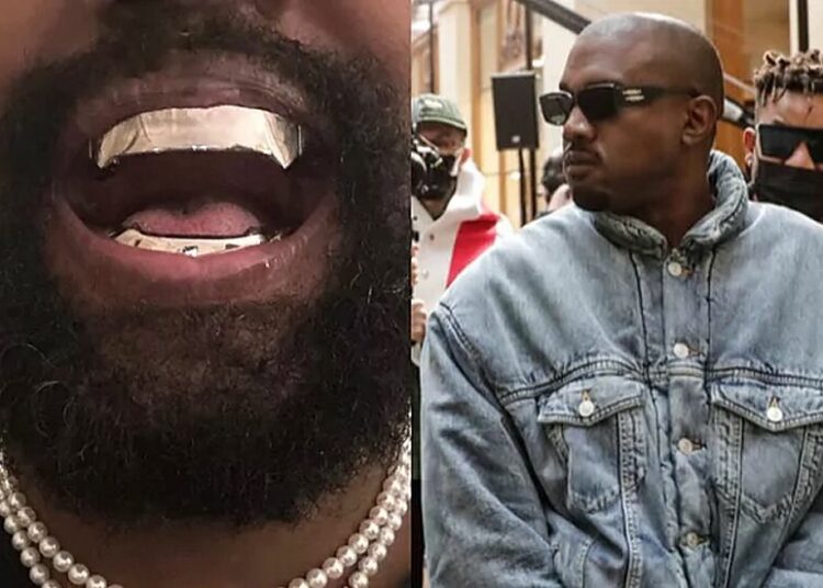 Kanye West se implantó una dentadura de titanio que vale 850.000 dólares