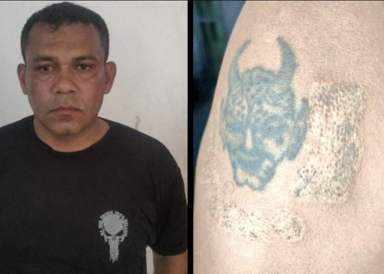 Pandillero se quemó la piel para ocultar sus tatuajes alusivos a las maras