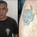 Pandillero se quemó la piel para ocultar sus tatuajes alusivos a las maras