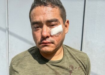 Capturan a sujeto que agredió a dos personas con una piedra en San Salvador
