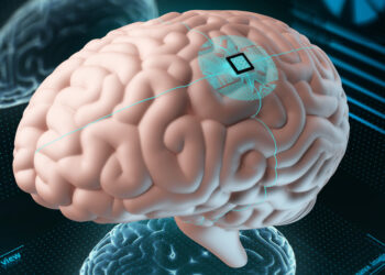 (VIDEO) Primer humano con el chip Neuralink muestra su ‘telepatía’