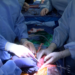 Por primera vez, un riñón de cerdo modificado genéticamente fue trasplantado con éxito a un humano