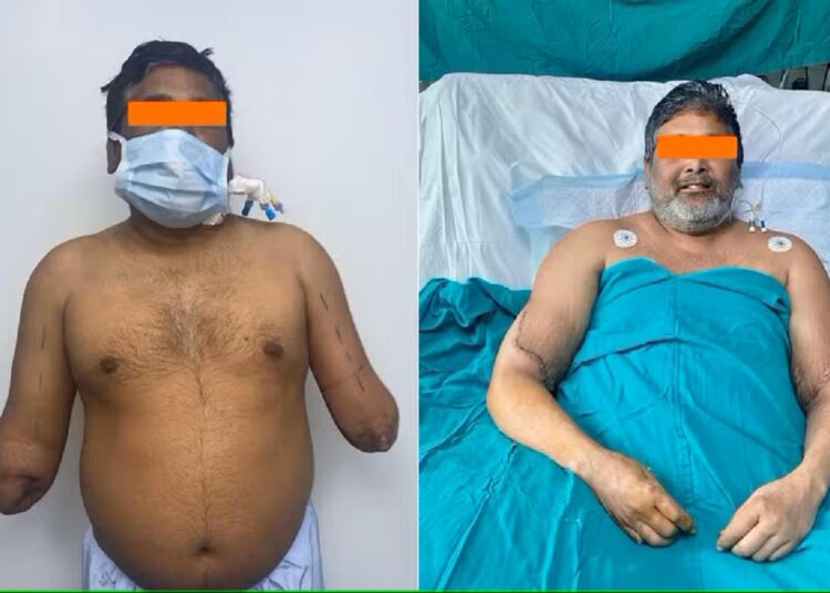 Pintor que perdió ambos brazos podría volver a crear tras un doble trasplante