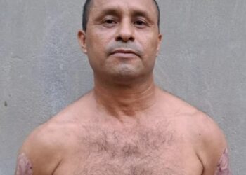 Gatillero de la 18R intentó eliminar sus tatuajes alusivos a las pandillas quemándolos