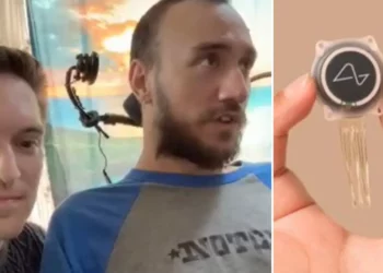 Primeras fallas en chip implantado a un cerebro de humano, que dijo Neuralink