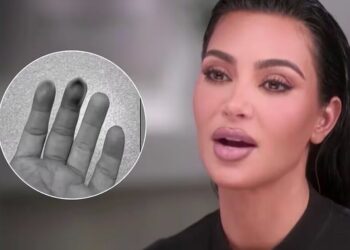 Kim Kardashian se fracturó su mano tras golpearse con una puerta