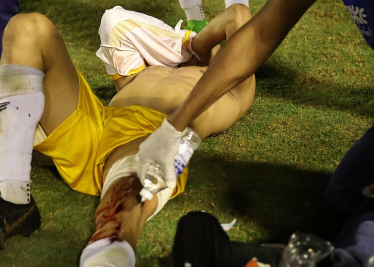 (IMÁGENES FUERTES) Un policía dispara en la pierna a un portero durante un partido