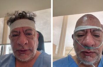 El controversial cazafantasmas mexicano Carlos Trejo reaparece con oxígeno y vendas en la cabeza