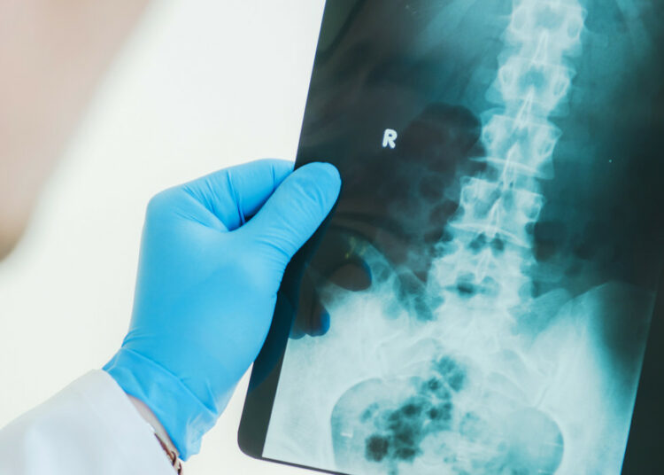 Obligan a los médicos británicos preguntar a los hombres si están en embarazo