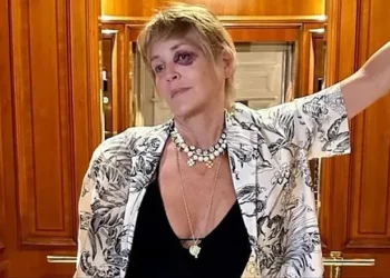 Sharon Stone aclara por qué tiene un ojo morado durante su viaje a Turquía