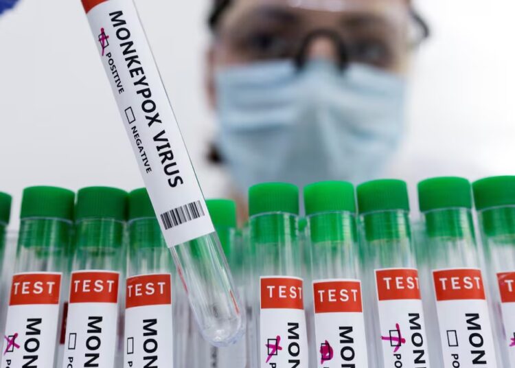 España reporta reducción en casos positivos de Mpox