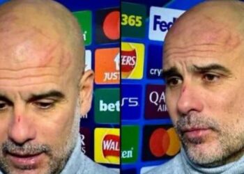 Guardiola apareció con lesiones tras el empate que sufrió el City luego de ir ganando 3-0