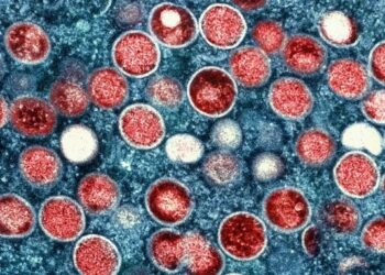 Estados Unidos detectó el primer caso de una variante más agresiva de la viruela del mono en California