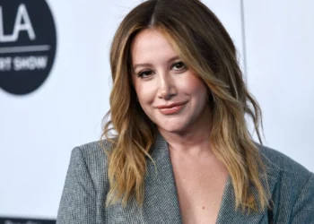 Ashley Tisdale se sinceró sobre su lucha contra la alopecia areata