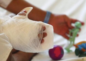 Protección Civil reporta reducción del 28 % en casos de personas quemadas por pólvora